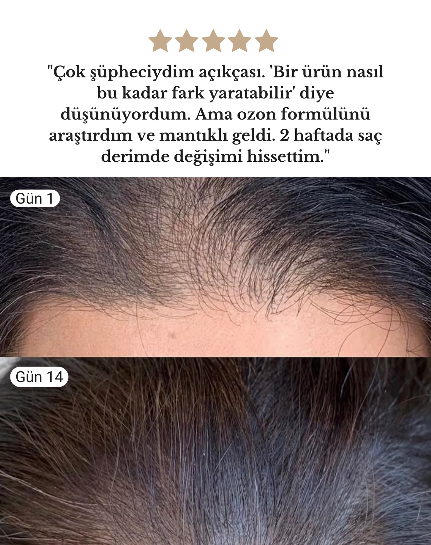 Woztie Saç Vitamini
