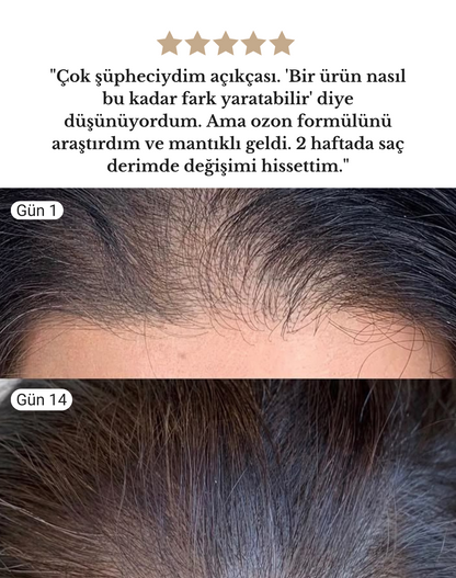 Woztie Saç Vitamini
